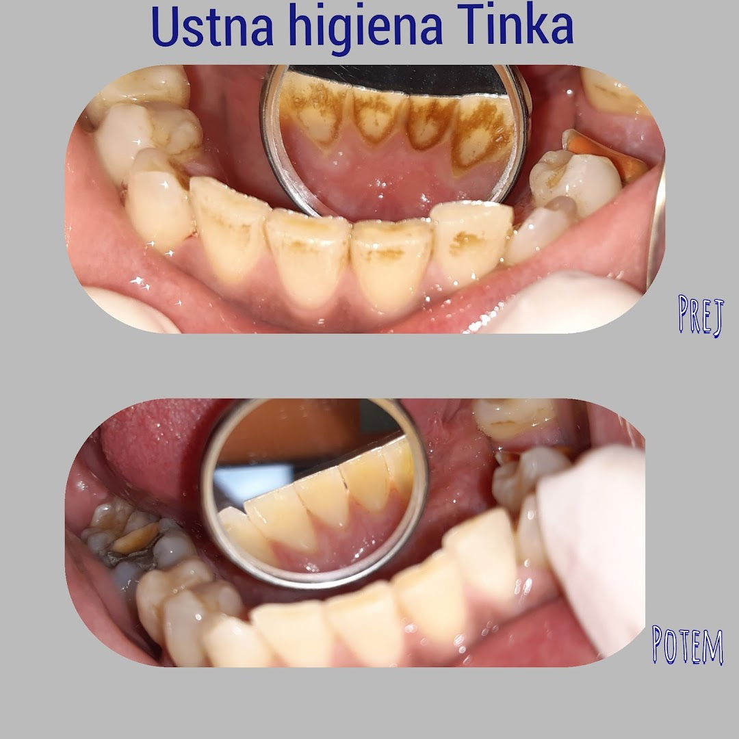 Ustna higiena Tinka Trajković s.p.