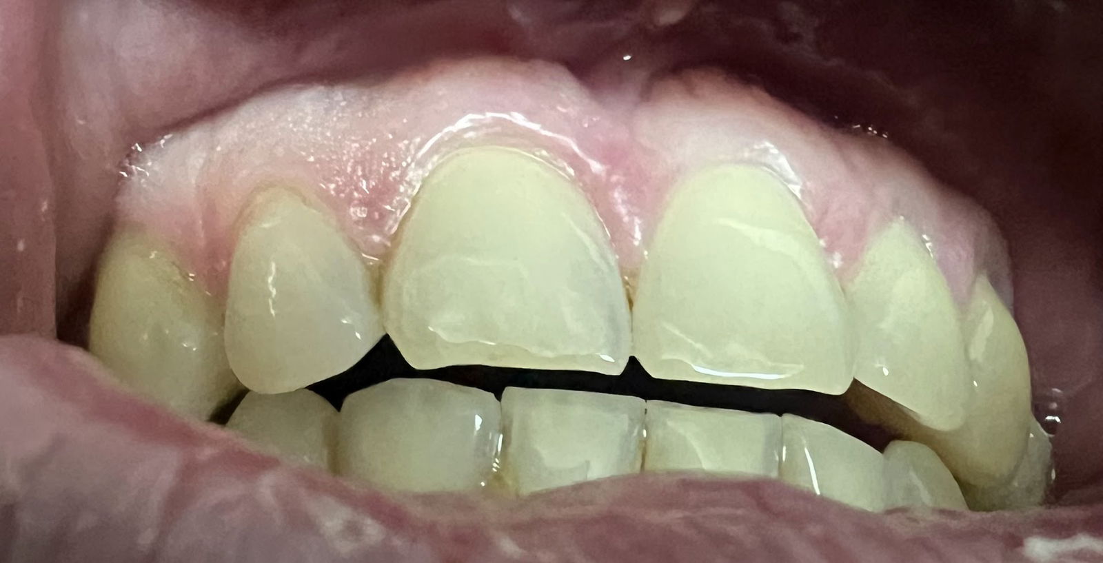 3D SNIMANJE ZUBA MC ORTOPAN MIRIJEVO KARABURMA