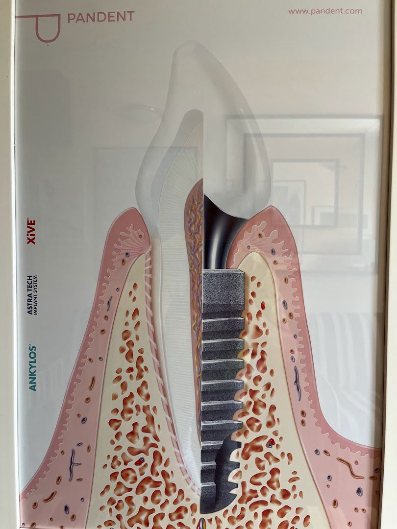 STOMATOLOŠKA ORDINACIJA SA USLUGAMA UGRADNJE IMPLANTATA dr. Robert Mostarčić