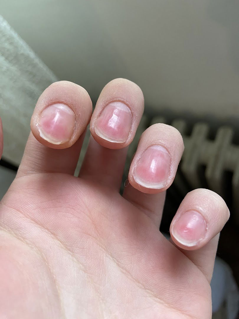 aOra Beauty Awareness