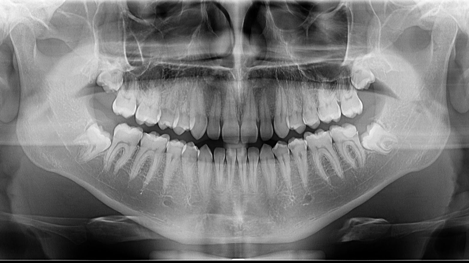 3D snimanje zuba - Dental Centar Petković