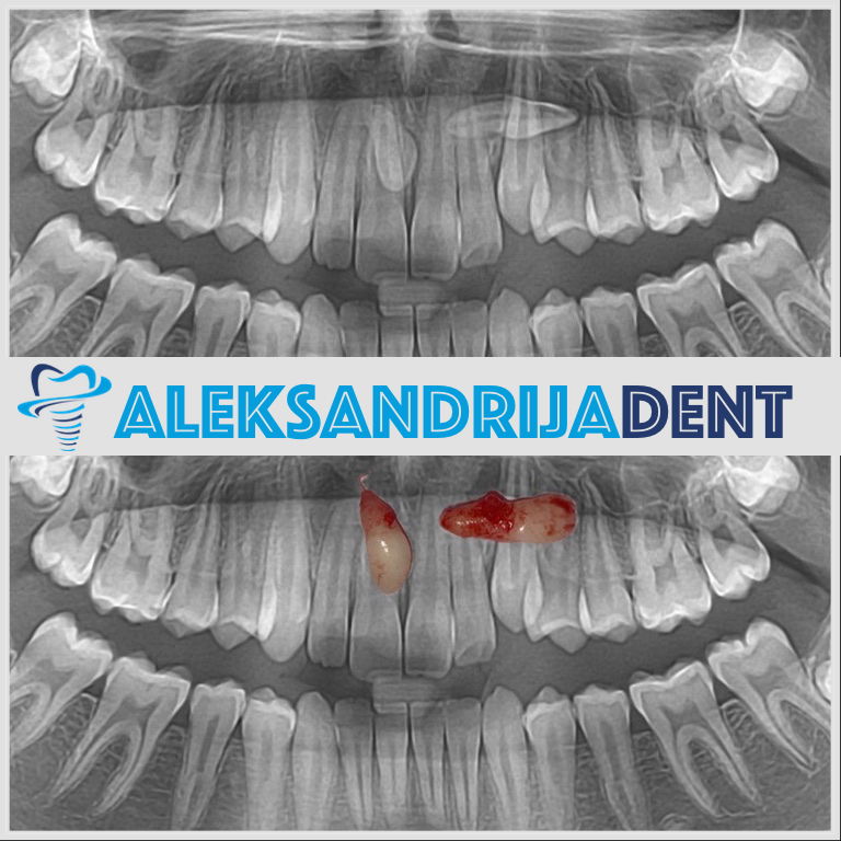Stomatološka ordinacija ALEKSANDRIJA