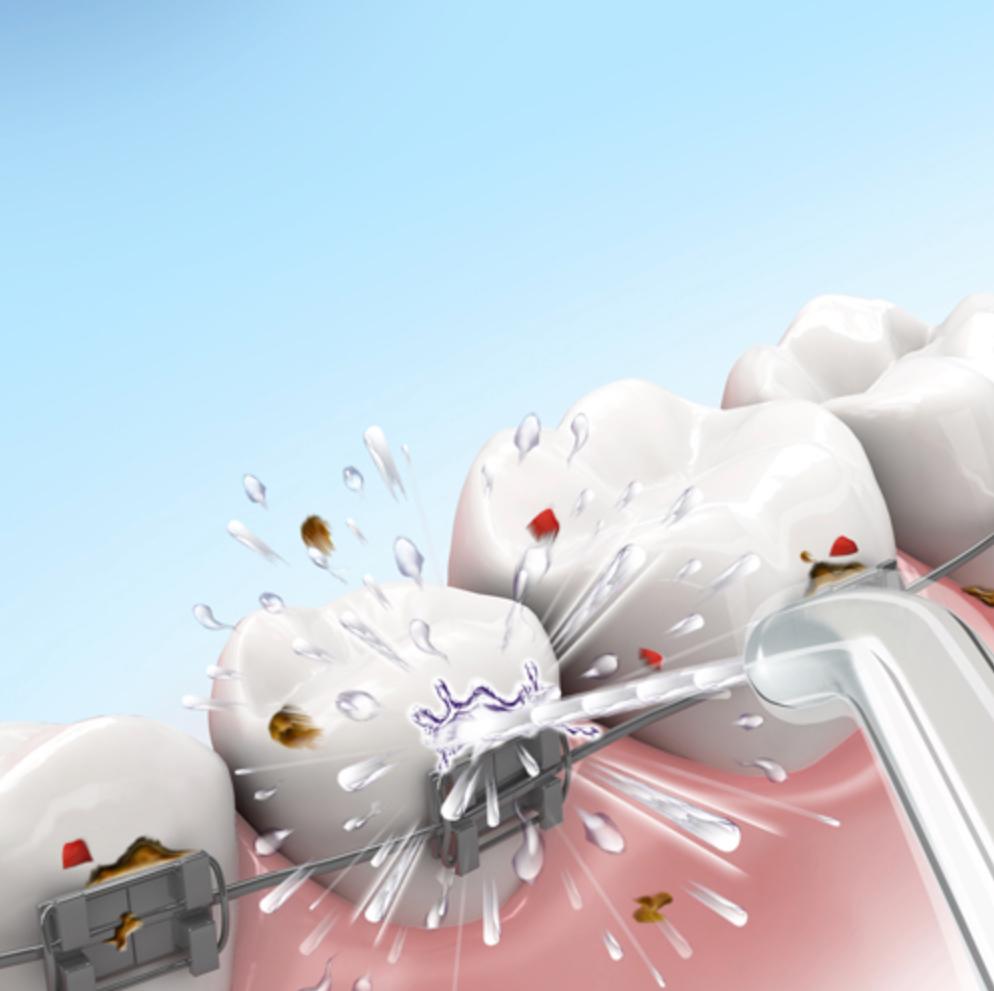 Oralni tuš Aquapick MIKODENTAL